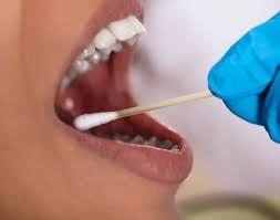 DNA testing sample collection