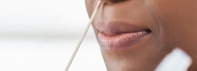 CLIA-waived rapid point-of-care testing
